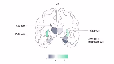Media Coverage of Our Research on Ultra-Processed Foods