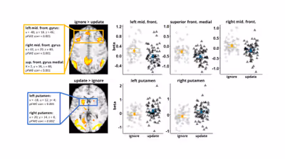 Our latest research on the relationship between obesity and working memory is out now!