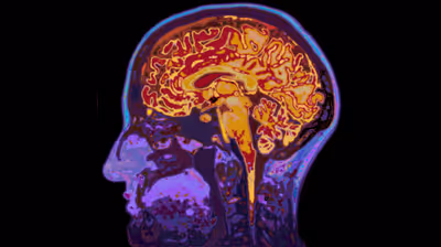 Annette Horstmann will be presenting at the “Big Questions in Neuroscience and Current Limits of Knowledge” event.